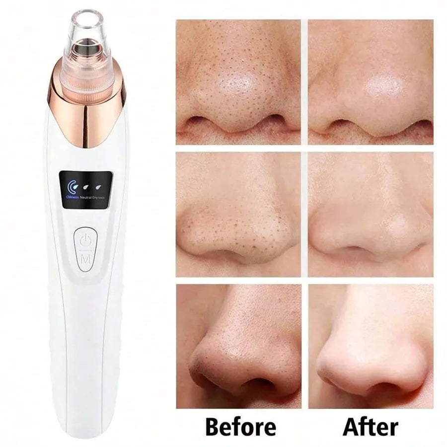 Electric Blackhead Remover Vacuum Cleaner