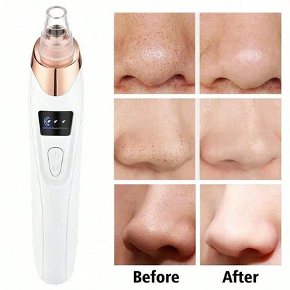 Electric Blackhead Remover Vacuum Cleaner