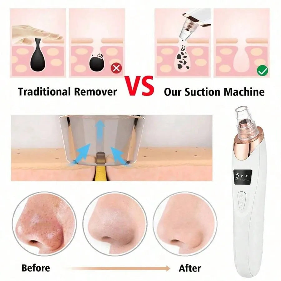 Electric Blackhead Remover Vacuum Cleaner